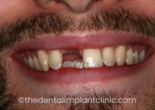 Case Image