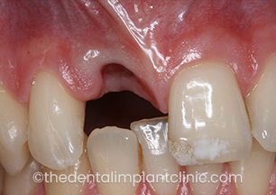 Case Image