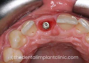 Case Image