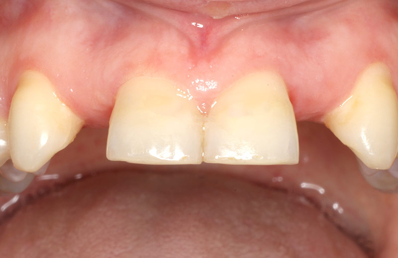 Before