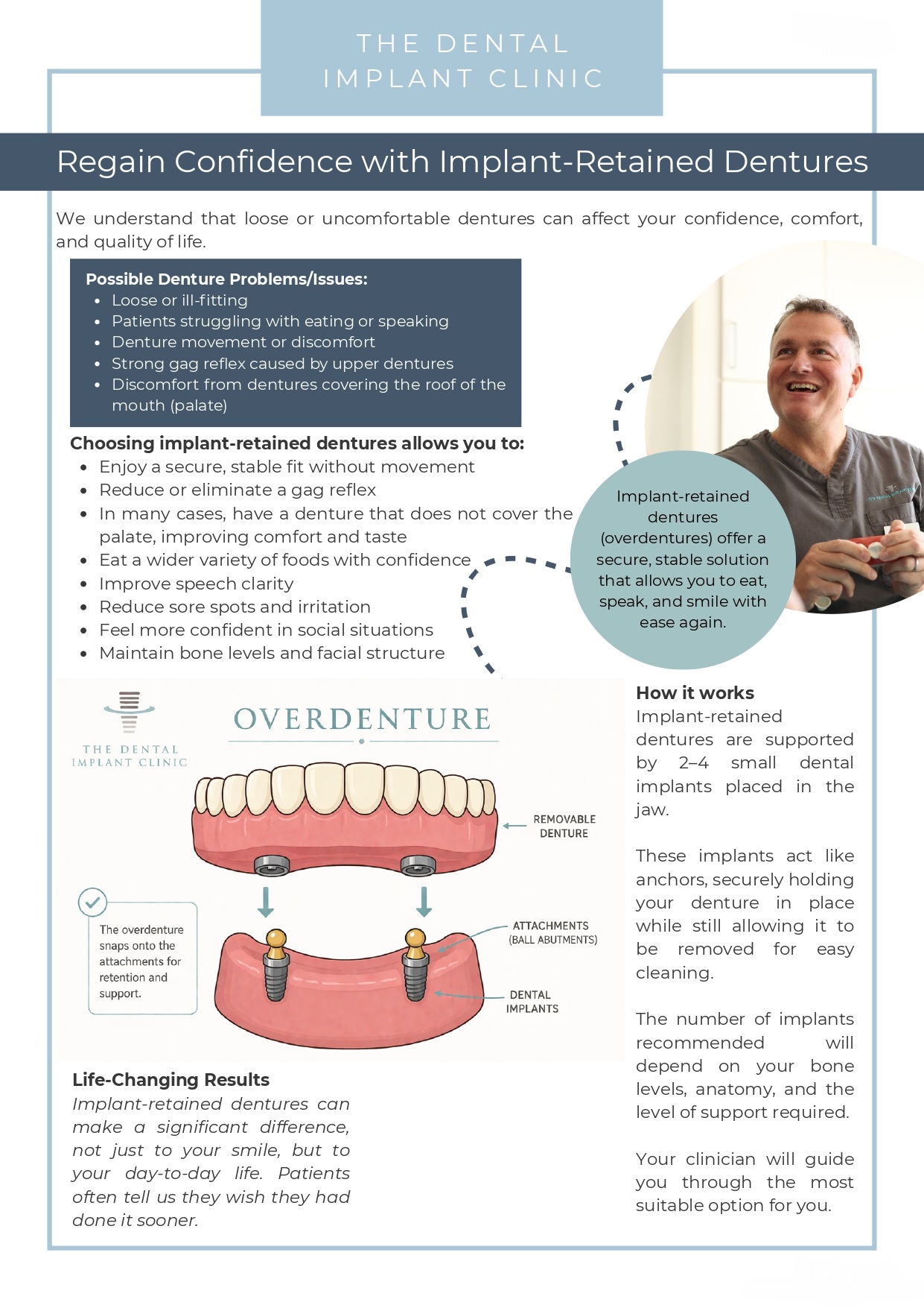 implant-retained-dentures