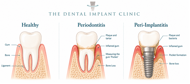 healthy-gums